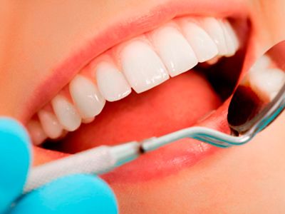 Clínica Dental Santamaría estética dental