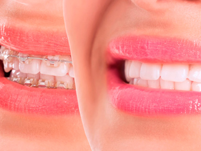Clínica Dental Santamaría ortodoncia