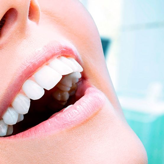 Clínica Dental Santamaría blanquemiento